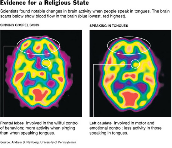 Two  scans of the brain, one ina subject speaking in tongues the other in a subject singing a gospel song
